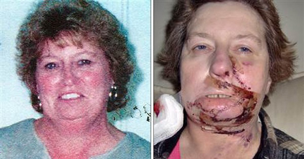 پنج اتفاق عجیب در میان عمل جراحی +تصاویر پنج اتفاق عجیب در میان عمل جراحی +تصاویر