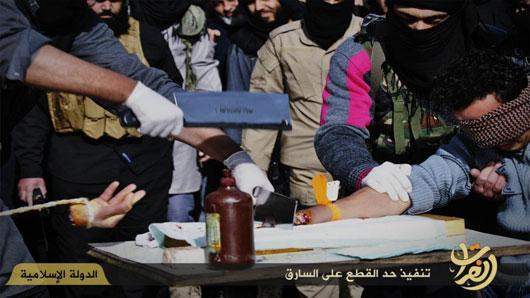 قطع دست با ساتور پزشکان داعش +تصاویر قطع دست با ساتور پزشکان داعش +تصاویر