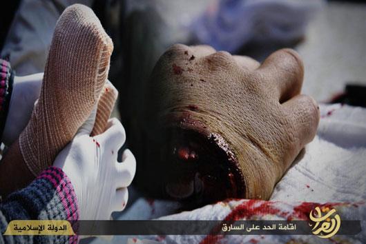 قطع دست با ساتور پزشکان داعش +تصاویر قطع دست با ساتور پزشکان داعش +تصاویر