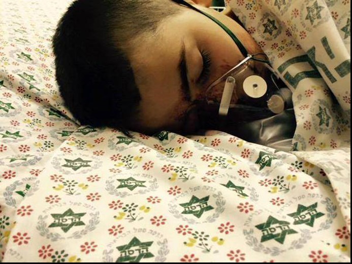 اصابت گلوله اسرائیلی بر صورت یک کودک+عکس اصابت گلوله اسرائیلی بر صورت یک کودک+عکس