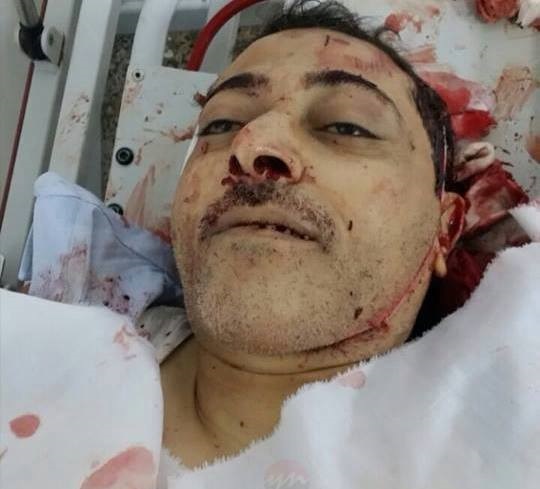 ترور مسئول اطلاعرسانی جنبش انصارالله یمن+عکس ترور مسئول اطلاعرسانی جنبش انصارالله یمن+عکس