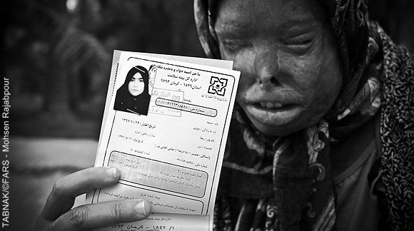 چشمهای رعنا و سمیه منتظر حمایت خیران چشمهای رعنا و سمیه منتظر حمایت خیران
