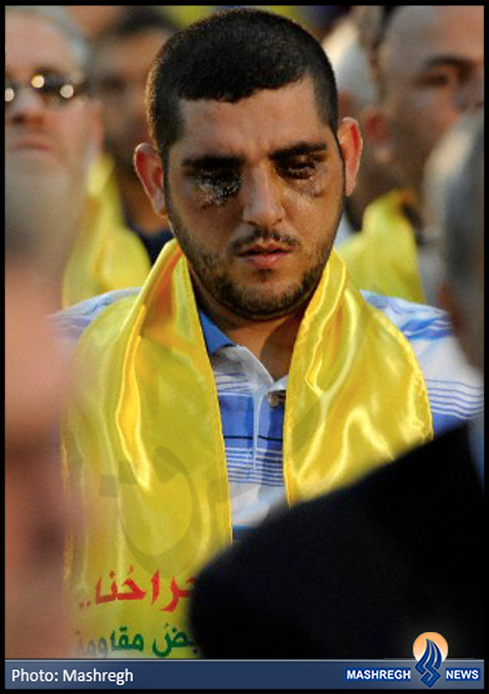 چشمانم فدای زینب(س)