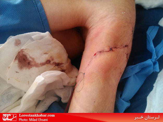 جزئیات تازه از حمله به طلبه آمر به معروف در لرستان جزئیات تازه از حمله به طلبه آمر به معروف در لرستان