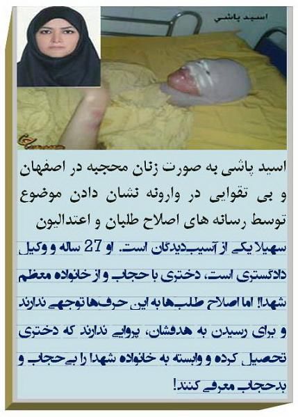 بانوی محجبه قربانی اسیدپاشی اصفهان+عکس بانوی محجبه قربانی اسیدپاشی اصفهان+عکس