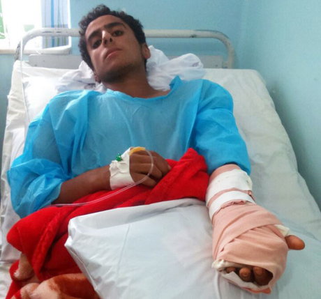 عفونت دست دانشآموز، به خاطر تنبیه + عکس عفونت دست دانشآموز، به خاطر تنبیه + عکس