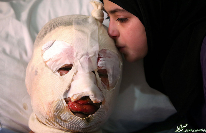 بوسه گریان دختر بر صورت پدر مجروحش +عکس بوسه گریان دختر بر صورت پدر مجروحش +عکس