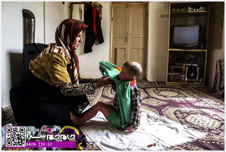 دختر بچهای با یک بیماری پوستی دردآور + تصاویر دختر بچهای با یک بیماری پوستی دردآور + تصاویر