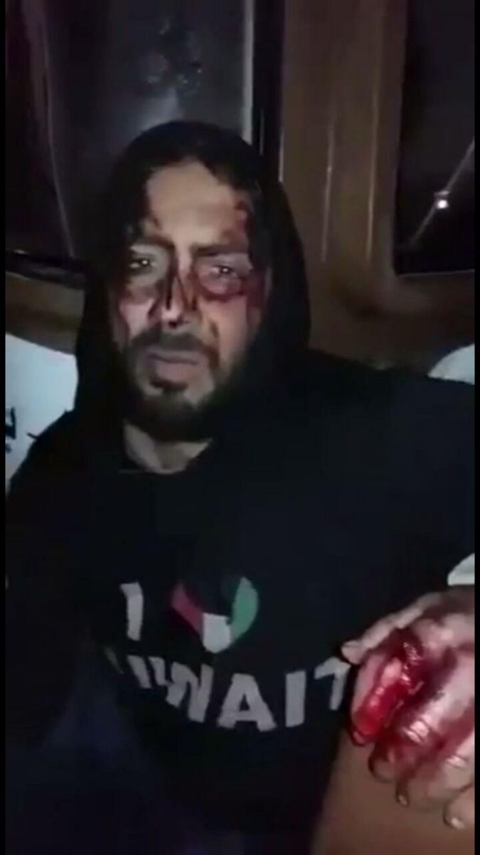 نظامیان کویتی انگشت صیاد ایرانی را بریدند!+عکس نظامیان کویتی انگشت صیاد ایرانی را بریدند!+عکس