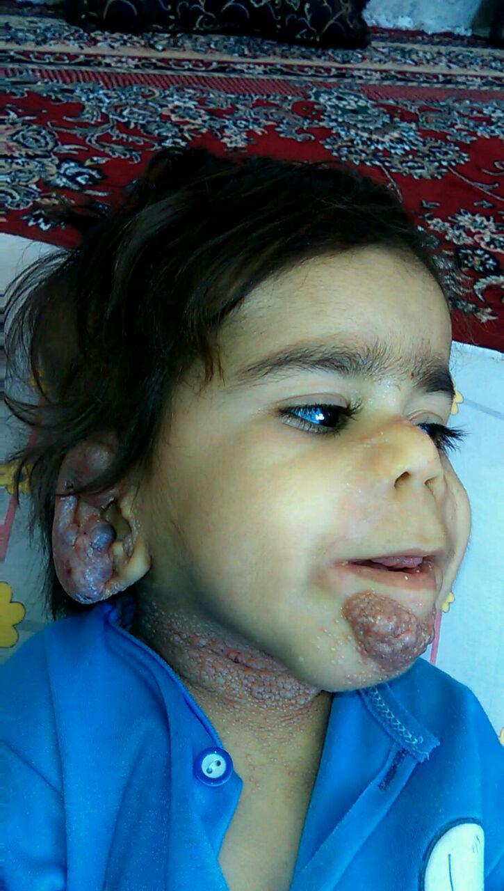 کودک 3 ساله، تنها بیمار کودک 3 ساله، تنها بیمار