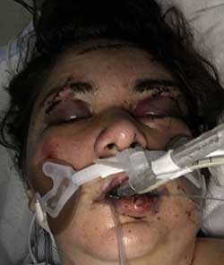 ضرب و شتم دختر مورد علاقه تا سرحد مرگ!+عکس ضرب و شتم دختر مورد علاقه تا سرحد مرگ!+عکس