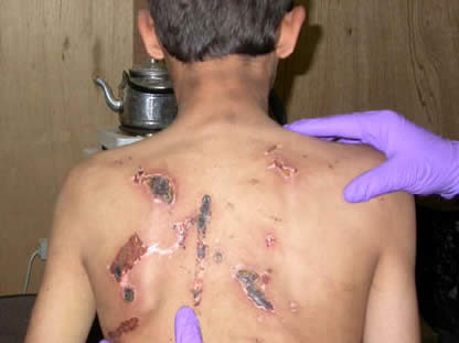 جنایاتی وحشیانهتر از داعش توسط آمریکا +تصاویر جنایاتی وحشیانهتر از داعش توسط آمریکا +تصاویر