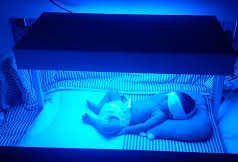 نوزاد ۳ روزه در دستگاه فتوتراپی سوخت +عکس نوزاد ۳ روزه در دستگاه فتوتراپی سوخت +عکس