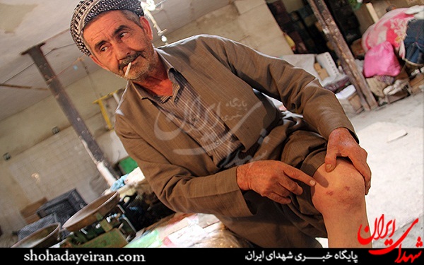 عکس/ شهری که مردمش شیمیایی هستند