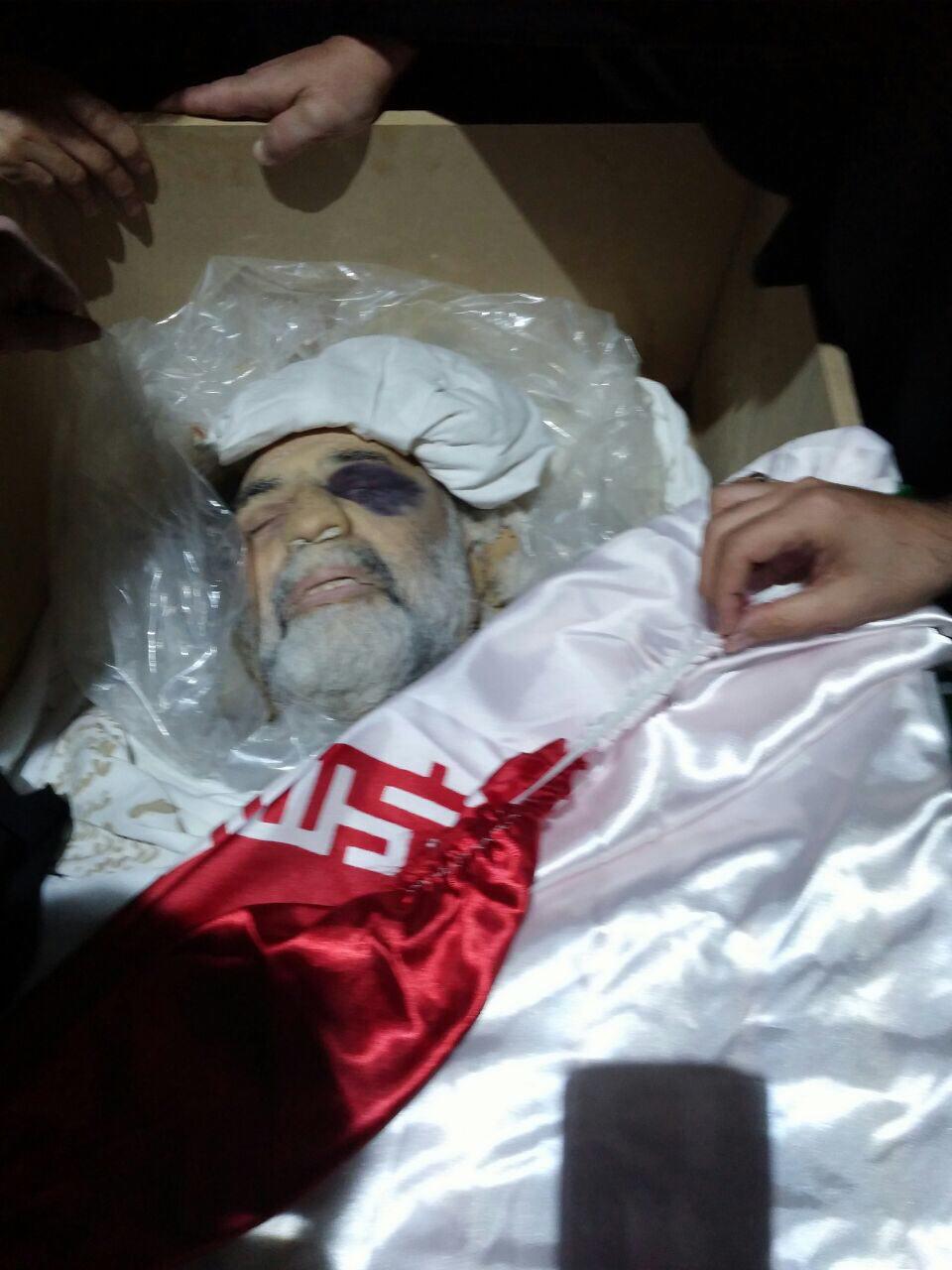 پیکر پاک و مطهر سردار شهید همدانی+عکس