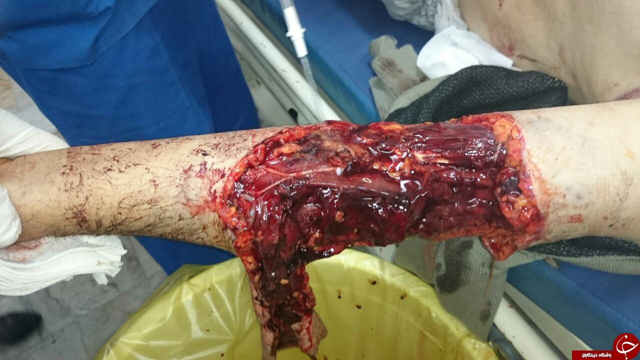 نبرد خونین مرد الموتی با یک قلاده خرس + تصاویر نبرد خونین مرد الموتی با یک قلاده خرس + تصاویر