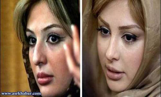تفاوت چهره بازیگران زن، قبل و بعد از عمل زیبایی +تصاویر تفاوت چهره بازیگران زن، قبل و بعد از عمل زیبایی +تصاویر