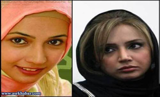 تفاوت چهره بازیگران زن، قبل و بعد از عمل زیبایی +تصاویر تفاوت چهره بازیگران زن، قبل و بعد از عمل زیبایی +تصاویر
