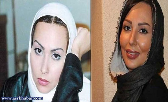 تفاوت چهره بازیگران زن، قبل و بعد از عمل زیبایی +تصاویر تفاوت چهره بازیگران زن، قبل و بعد از عمل زیبایی +تصاویر