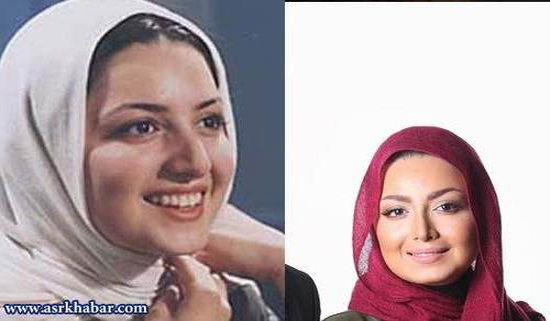تفاوت چهره بازیگران زن، قبل و بعد از عمل زیبایی +تصاویر تفاوت چهره بازیگران زن، قبل و بعد از عمل زیبایی +تصاویر