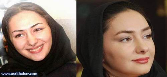 تفاوت چهره بازیگران زن، قبل و بعد از عمل زیبایی +تصاویر تفاوت چهره بازیگران زن، قبل و بعد از عمل زیبایی +تصاویر