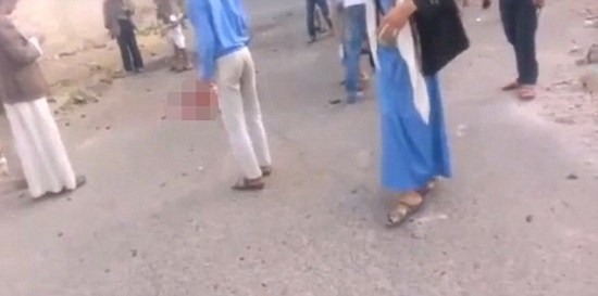 زنده ماندن داعشی پس از عملیات انتحاری!+عکس زنده ماندن داعشی پس از عملیات انتحاری!+عکس