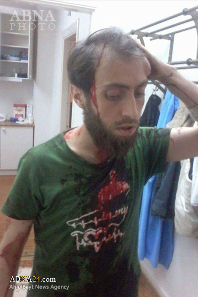 ضرب و شتم یک پناهجوی سوری در سوئد!+عکس ضرب و شتم یک پناهجوی سوری در سوئد!+عکس