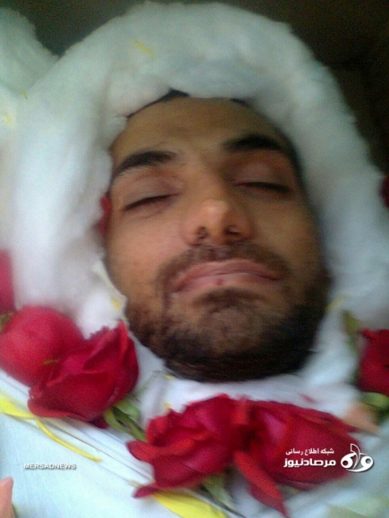 حکایت بوسه حاج قاسم بر دست رزمنده مدافع حرم حکایت بوسه حاج قاسم بر دست رزمنده مدافع حرم