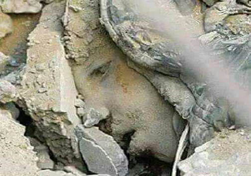 کودکی که زیر بمباران سعودی‌ها،دفن شد!+عکس
