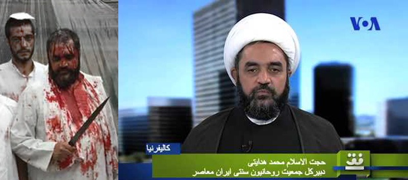 قمه زنی کارشناس صدای آمریکا !+عکس قمه زنی کارشناس صدای آمریکا !+عکس