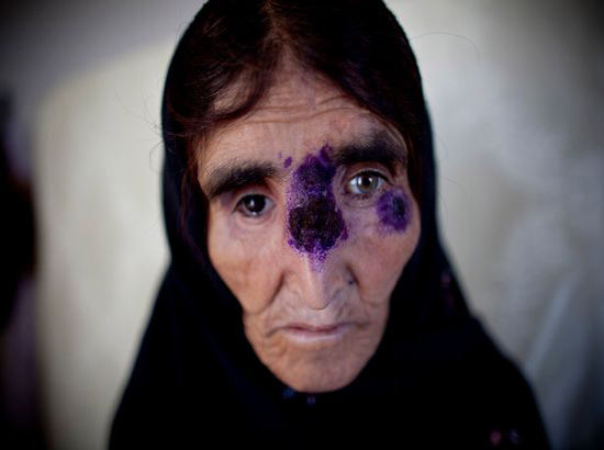 شیوع شیوع