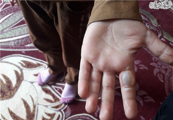 تنبیه بدنی یک دانشآموز توسط معلم+ عکس تنبیه بدنی یک دانشآموز توسط معلم+ عکس