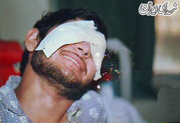 گذر از هفت خان برای تهیه داروهای جانبازان شیمیایی گذر از هفت خان برای تهیه داروهای جانبازان شیمیایی