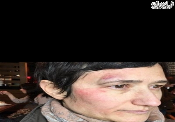 اعتراض دانشجویان به فاشیسم اردوغانی+عکس اعتراض دانشجویان به فاشیسم اردوغانی+عکس