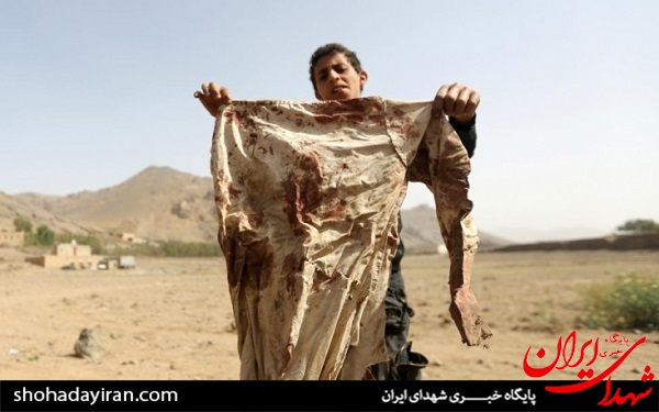 عکس/ جنگ در یمن