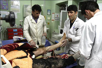 ترقه چشم دختر 25 ساله را در مهاباد گرفت
