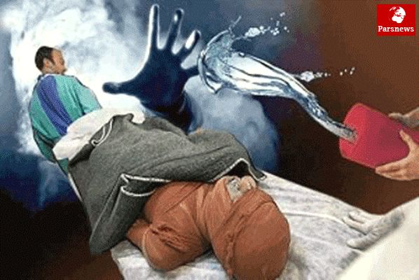 آخرین خبر از اسیدپاشی در آرایشگاه زنانه نهاوند