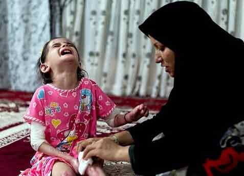 زخم پروانههای کوچک در جستجوی مرهم+عکس زخم پروانههای کوچک در جستجوی مرهم+عکس