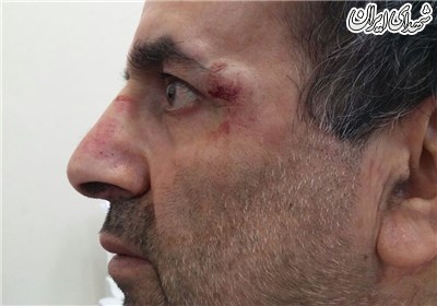زورگیری خشن از جانباز ویلچری در روز روشن +تصاویر