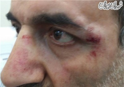زورگیری خشن از جانباز ویلچری در روز روشن +تصاویر