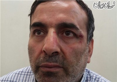 زورگیری خشن از جانباز ویلچری در روز روشن +تصاویر