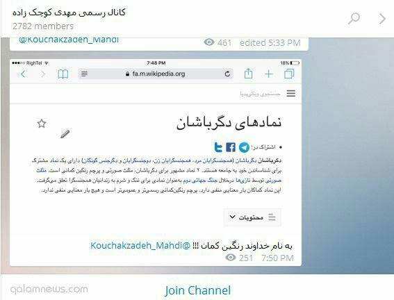 عکس/ واکنش کوچک زاده به شعر یک نماینده مجلس