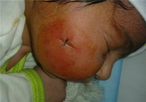 تکرار یک حادثه پزشکی دلخراش+عکس تکرار یک حادثه پزشکی دلخراش+عکس