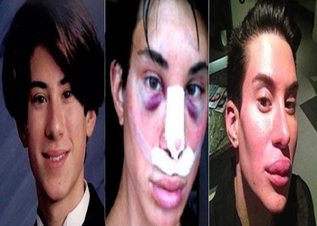 گشت و گذاری در کلینیکهای زیبایی مردانه گشت و گذاری در کلینیکهای زیبایی مردانه