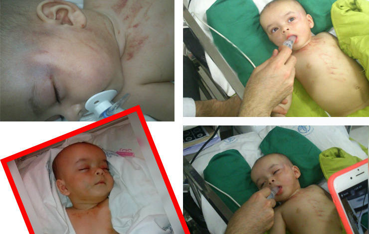 آزار دلخراش یک نوزاد 5 ماهه در رشت؟!+عکس آزار دلخراش یک نوزاد 5 ماهه در رشت؟!+عکس
