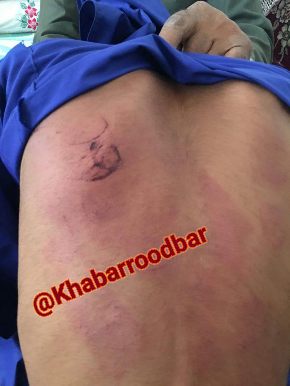 تنبیه بیرحمانه یک دانش آموز توسط معلم+عکس تنبیه بیرحمانه یک دانش آموز توسط معلم+عکس