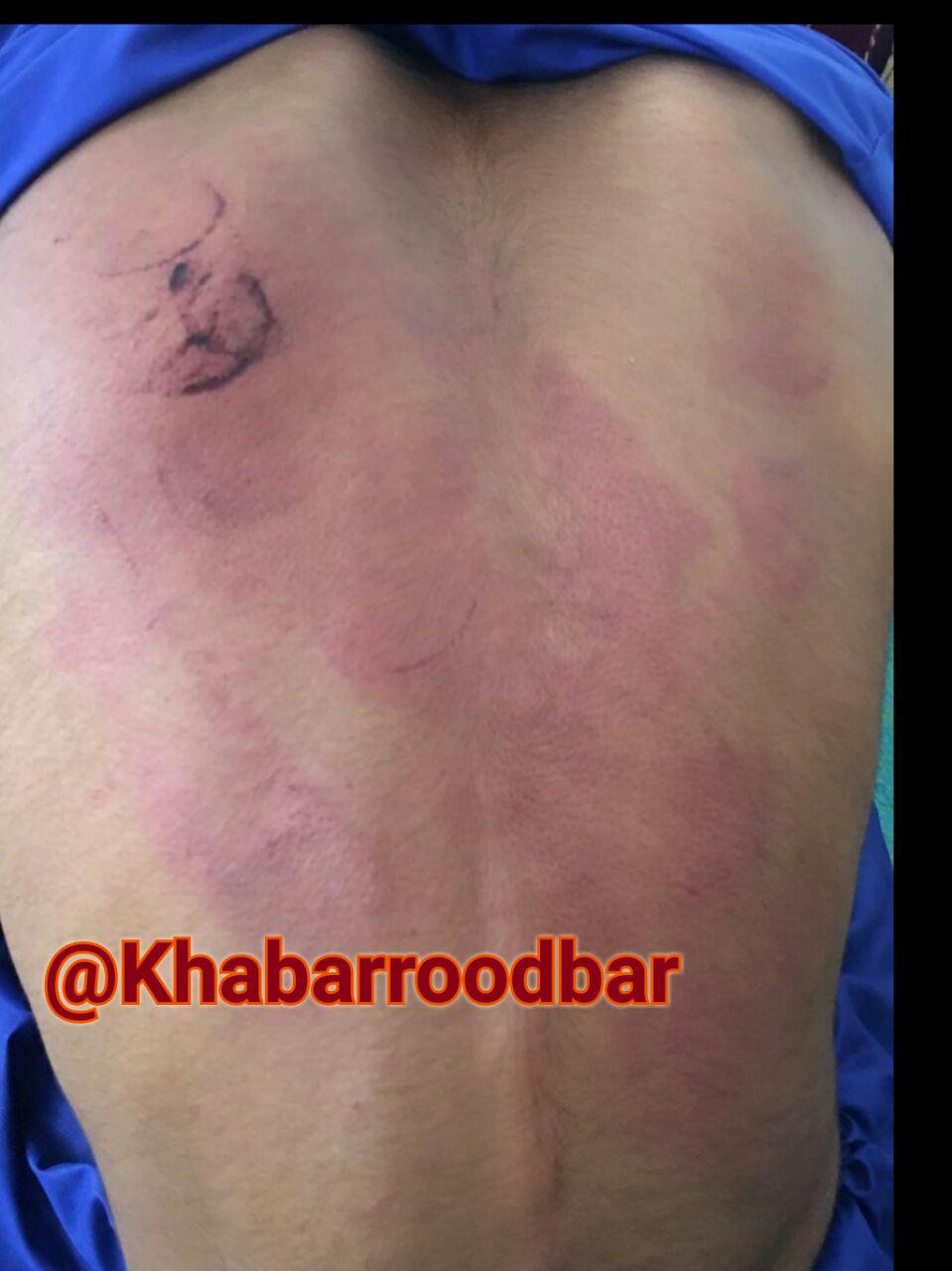 تنبیه بیرحمانه یک دانش آموز توسط معلم+عکس تنبیه بیرحمانه یک دانش آموز توسط معلم+عکس