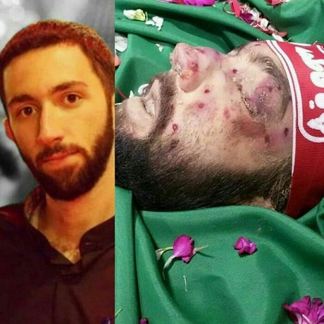 از خون شهدای فاطمیه شرم کنید!/لقمه چرب دنیا چه بر سر برخی از مسئولان و مثلا خواص این جامعه آورده؟