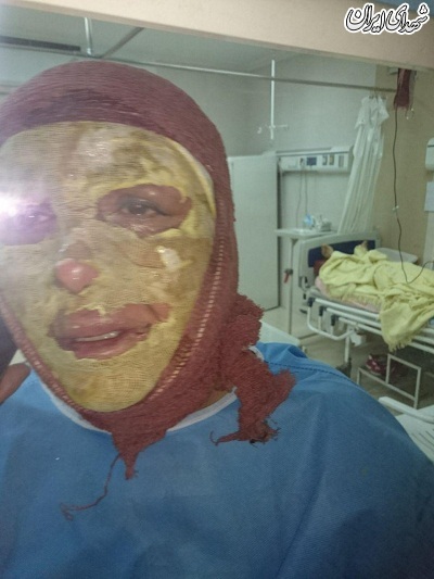 خودسوزی همسر جانباز فراموش شد! خودسوزی همسر جانباز فراموش شد!