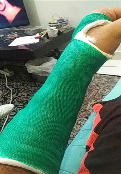 ملی پوش بسکتبال دستش را گچ گرفت+عکس ملی پوش بسکتبال دستش را گچ گرفت+عکس